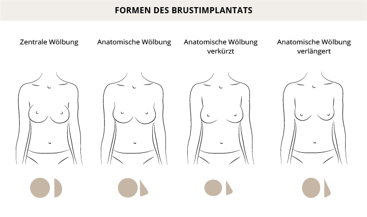 Formen Brustimplantate, Klinik am Pelikanplatz, Hannover, Dr. Entezami 